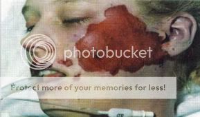 Tammy Homolka, morgue photo